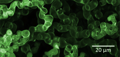 Pekilosienirihmastoa. Kuva: Eniferbio